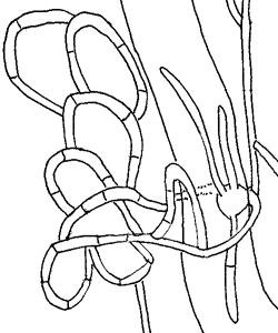 Fangnetz von Arthrobotrys oligospora mit gefangenem Nematoden
