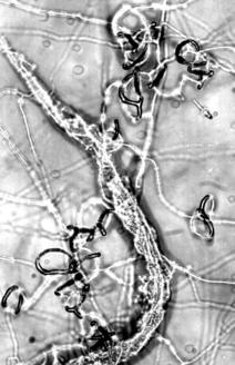 Halb verdauter Nematode im Fangnetz von Arthrobotrys oligospora